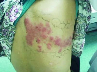 画条|大爷在脸上画条龙，结果面瘫了