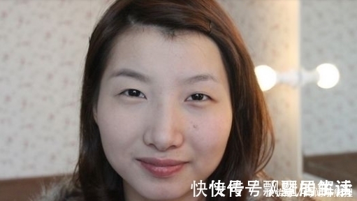 双眼皮|手术割了双眼皮的人,老了之后有什么影响?看完真要留意了