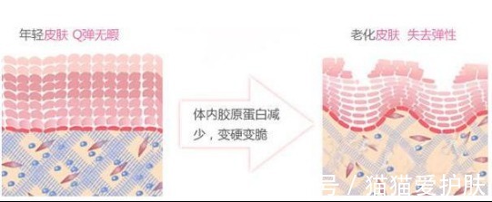 衰老|14岁的全红婵都夺冠了，你却还没开始抗初老？？