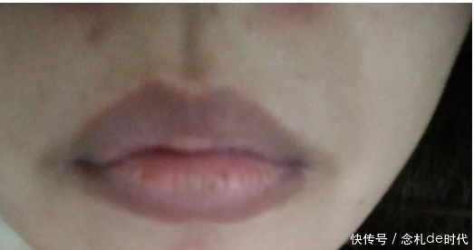 “肝”不好的人,嘴巴和眼睛可能会有几种变化,请不要忽视