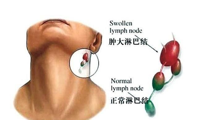 疼痛|医生说,体内有癌,身体往往有4个标志,具体都是什么呢