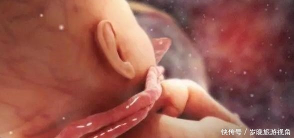 威胁|为何会有脐带绕颈没有想象中那么可怕,做到4点让胎儿远离威胁