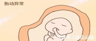 胎动|孕期这些胎动极不正常, 若疏忽大意, 可能酿早产或流产!
