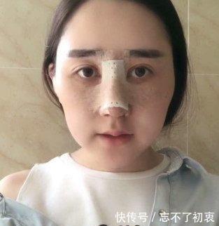 男友|女子被男友嫌弃“猪鼻子”,愤怒整容十几次,现在居然成陌陌女神