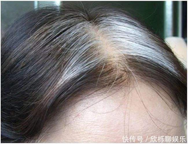 40岁不到，白发乱冒，怎样做才能让白头发来得慢点？