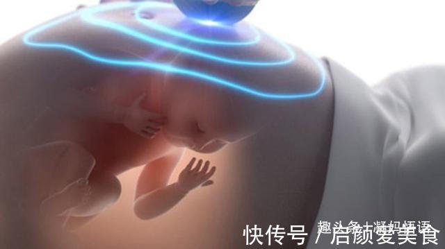 胎儿|孕妇打喷嚏时，胎儿在肚子里会有3种反应，孕妈要小心呵护