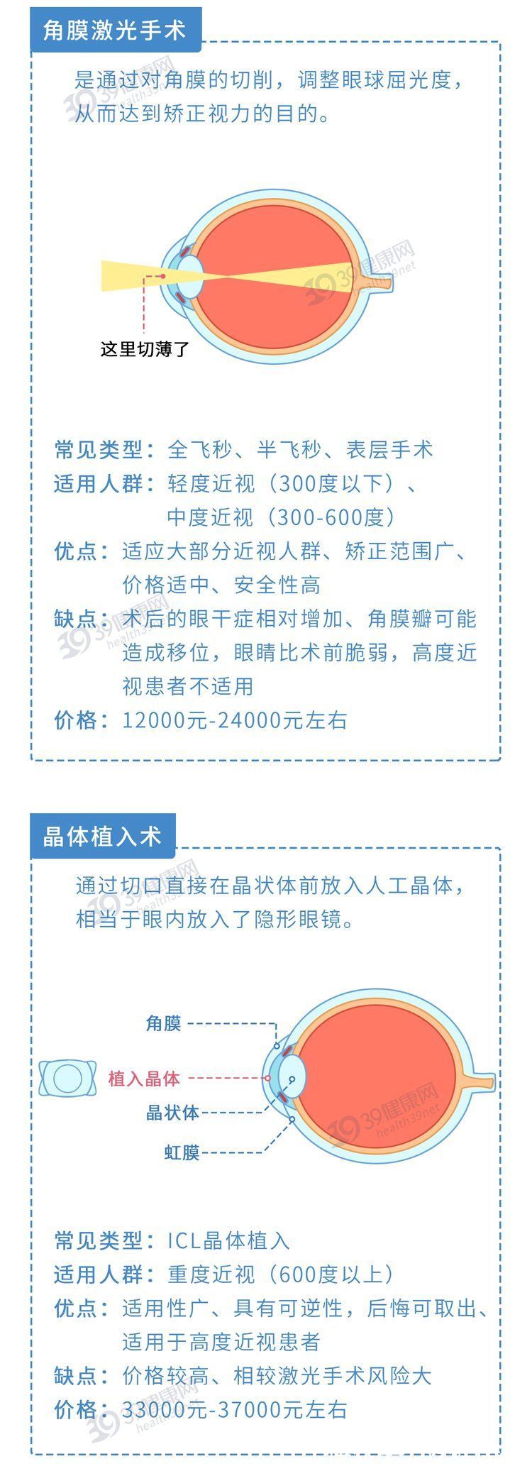 近视手术|做过近视手术的人，现在都怎样了？后遗症会多严重？一名患者自述