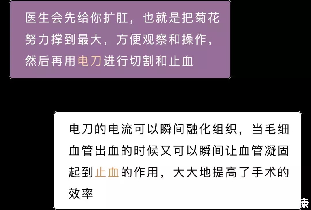 趣读丨痔疮手术的姿势到底有多羞耻！！