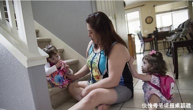 父母|连体双胞胎做分离手术成功,每人分得一条腿,父母喜极而泣!