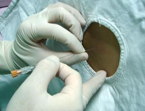 一文|有备无患,一文了解麻醉的那些事儿