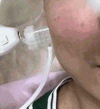 爱豆们竞当医美达人？男性适合的轻医美项目top5合集