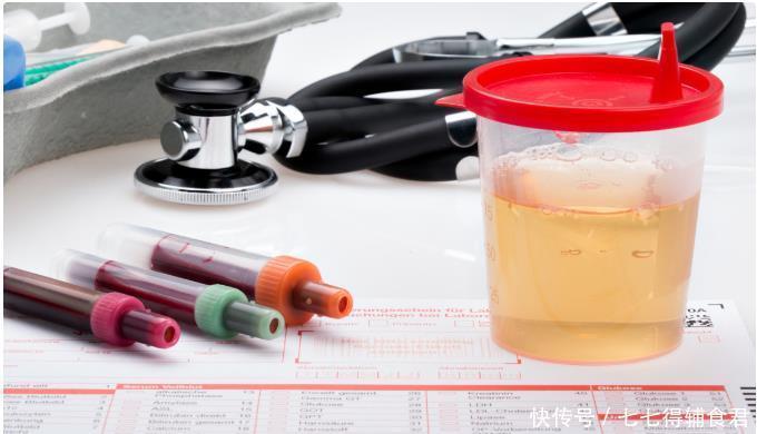 治疗|哪些不良习惯会导致前列腺癌？如何检查及治疗？医生告诉您