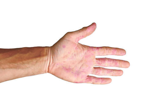  有肝病的人，不能吃鸡蛋？提醒：这3物才伤肝，早该拉入黑名单