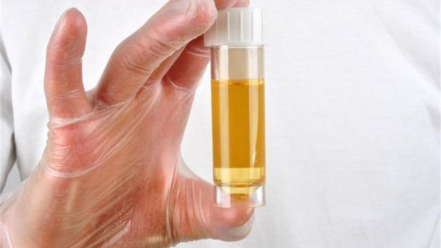 湿气|女人湿气重,身体三处会“变黄”,常喝四水,祛湿排毒一身轻