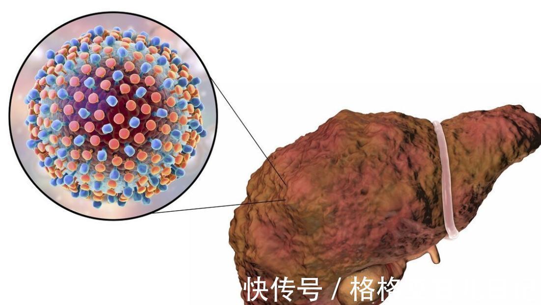 难度系数|什么癌症最“难缠”？这4种癌症，理应“榜上有名”