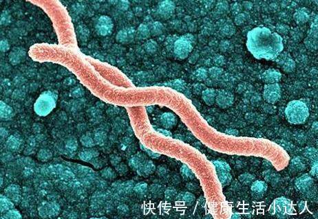 小左|23岁姑娘,胃疼2周没重视,确诊胃癌,要全胃切除,医生惋惜