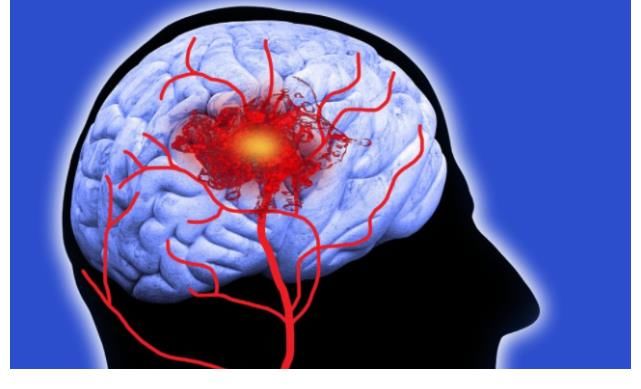 喝水|吃一口胜过8斤燕麦，敞开吃，降血脂软化血管，脑梗不叨扰