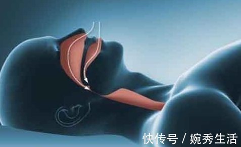 睡眠质量|凌晨3点左右自然醒来,就一直睡不着,或许是4种疾病在捣乱