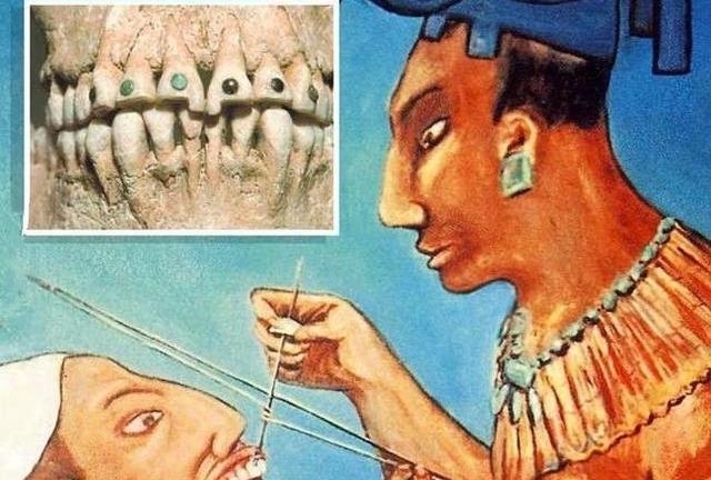 潮流|富商钻石牙惹来痛苦,牙钻潮流,玛雅人早玩过了