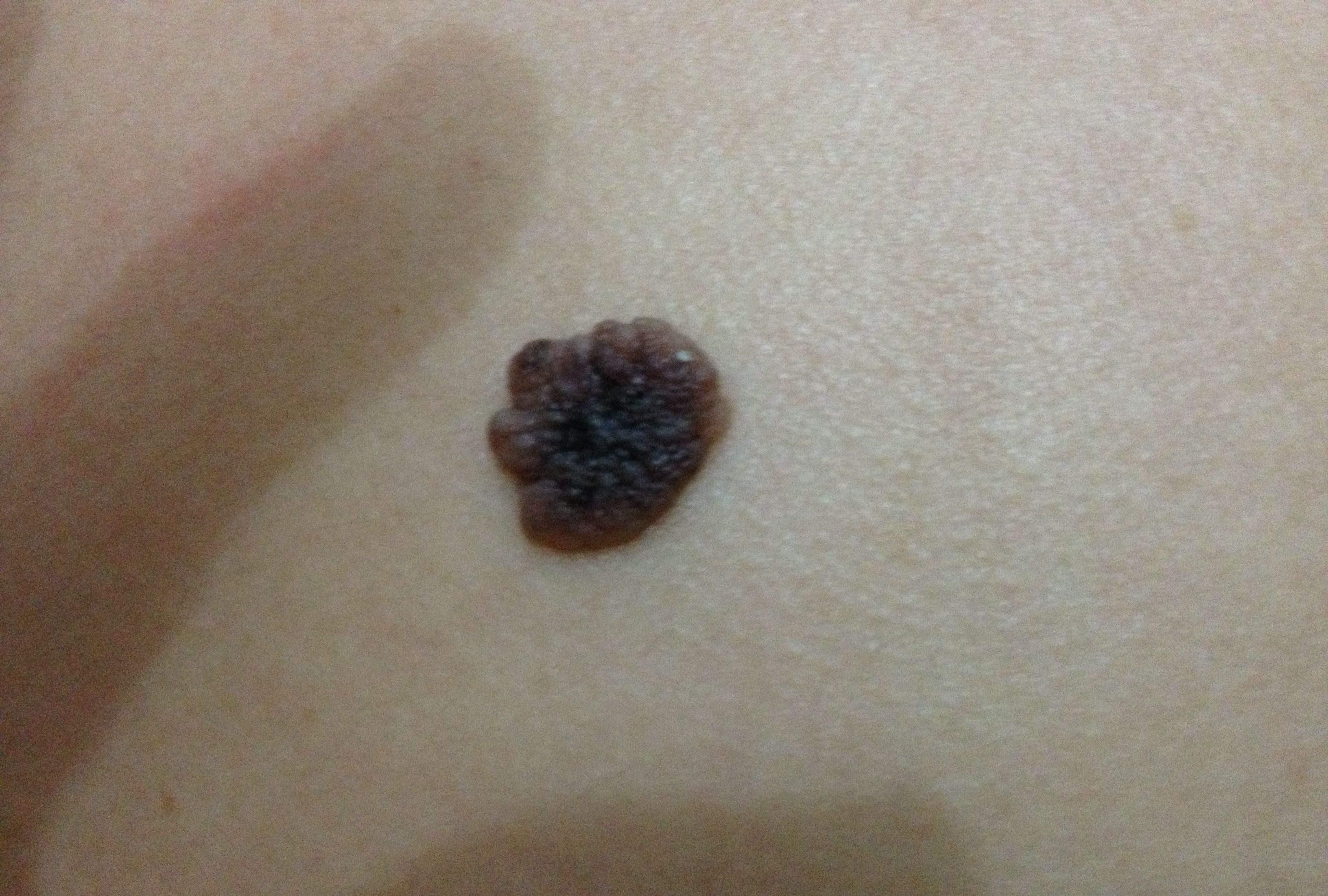 肝脏好不好,看手就知道,手上出现这3种异常,或许是肝脏生病了