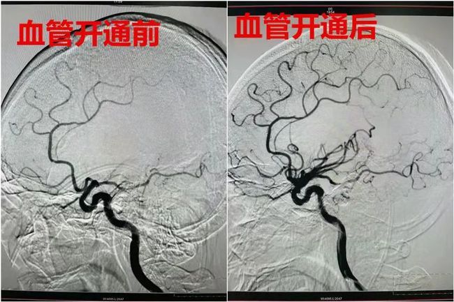 刘大爷|太吓人！静点头孢后喝了二两白酒......