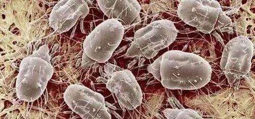 原来螨虫最怕的是这个,床上放一些,螨虫断子绝孙,绝不含糊