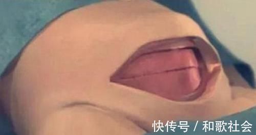 子宫|剖腹产只是“挨一刀”就完事?看完手术全过程,忍不住心疼女人