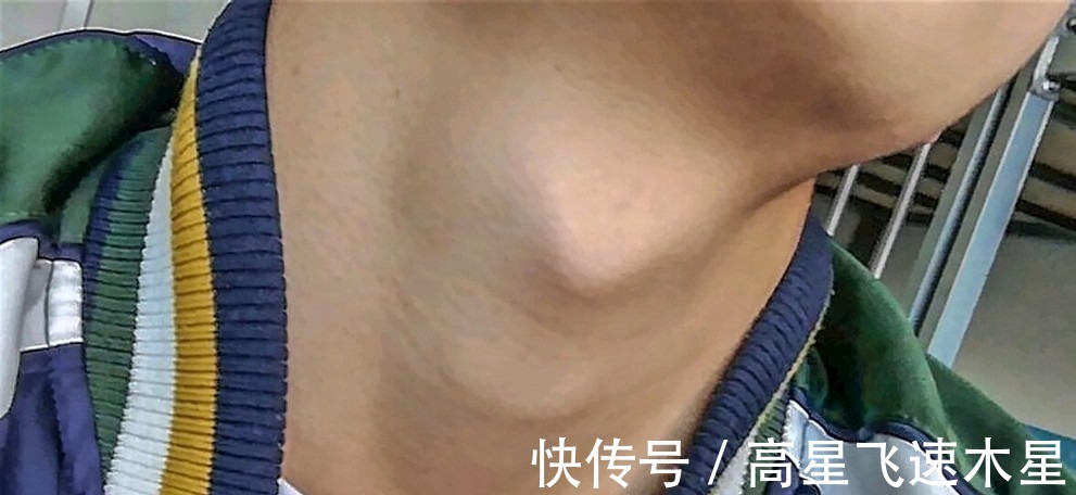 异常|青春期孩子有这3个“异常”,身高或受到“限制”,若一个不占,长高180不是梦