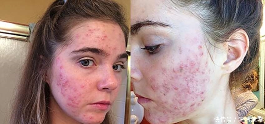 原来洗脸还有这么大的学问，别在乱洗脸了，现在知道还不晚