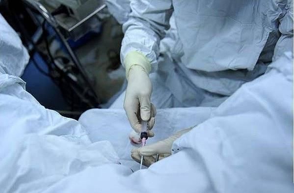 胚胎|揭秘试管婴儿全过程(附图)，看完后心疼女性一万遍