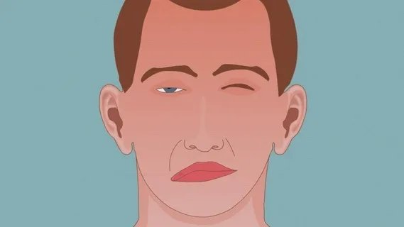 浙大一院|70岁奶奶总爱挤眉弄眼、做鬼脸，原来是肌肉出了问题