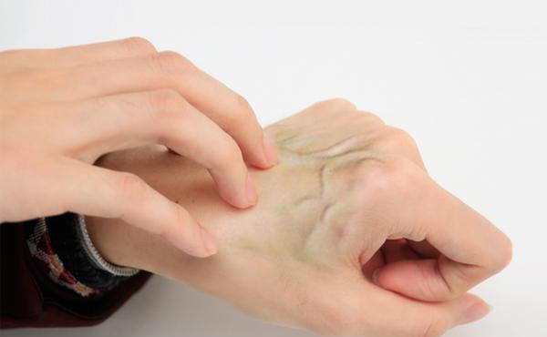 指甲|肝不好,双手会有提示,3个异常表现,伸出双手看看你有没有