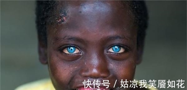 眼睛|男孩从小眼睛是蓝色的,长大后去医院检查的结果,让人惋惜了