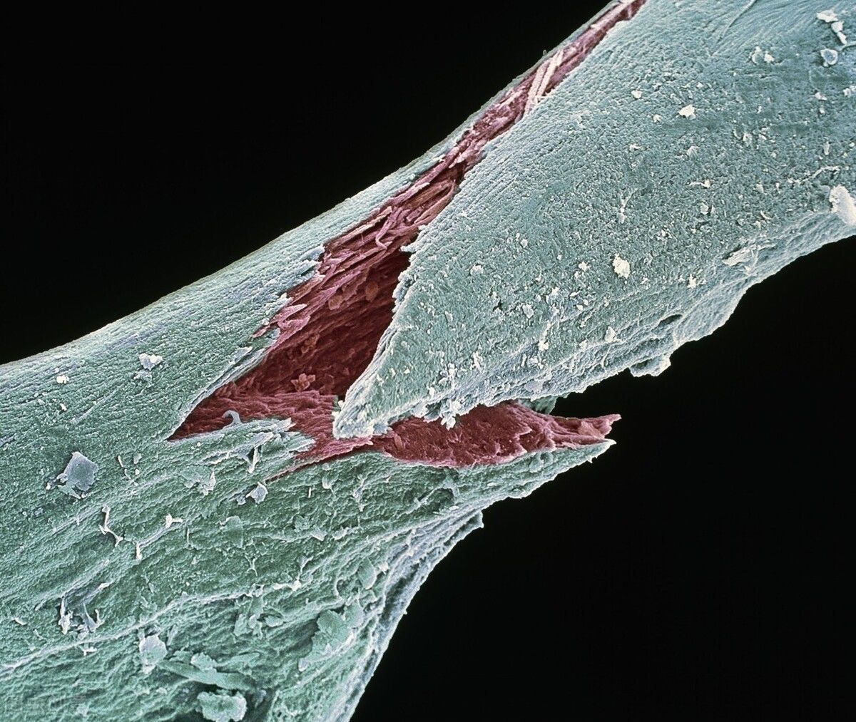 骨骼|骨质疏松不能吃鸡蛋？骨科医生：要想骨骼健康，2种食物别太贪吃