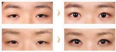 年纪轻轻就失去少女感，还能补救吗？