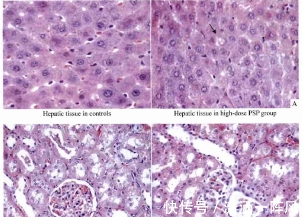 剧毒|比眼镜蛇毒强80倍的剧毒,为何出现在吃了几十年的海鲜里?
