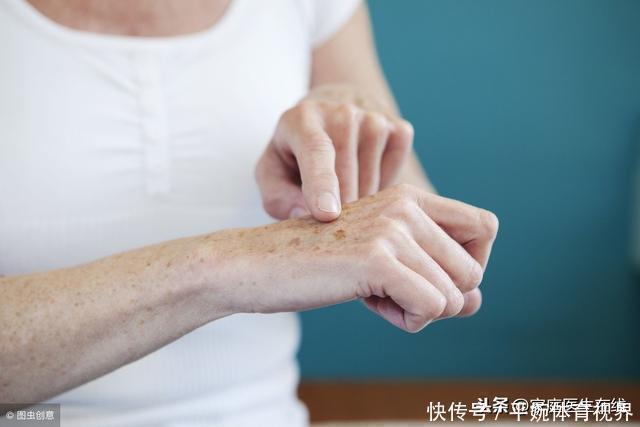 中年人|老人斑是身体代谢的结果,学会3个方法,年纪大了也不会长斑