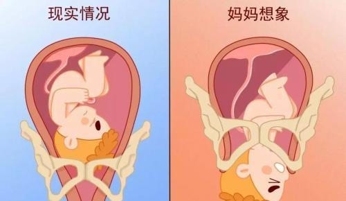 宫缩|卸货前,这些知识医生不会提前告诉你,孕妈提早知,击穿分娩障碍