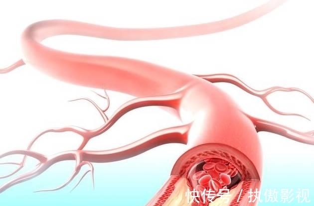 餐馆|3种食物是血管“溶解剂”，血脂高不妨多吃，降血脂“轻而易举”