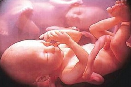 顺产|孕妇为顺产半夜爬楼梯,没想到孩子出生后,全家人已是泪流满面!