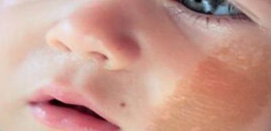 饮食习惯|怀孕期间要注意的几个事项, 否则宝宝会长胎记, 尤其是第2个