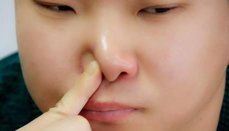 寒冷|你的体内是“寒多”还是“热多”,怎么才能辨别?早知早受益!