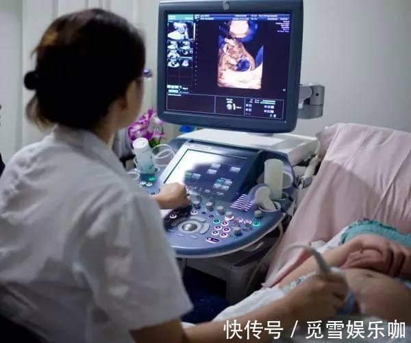 超声检查|四维彩超啥时候效果最好?太早太晚都不行,选对时期能看清娃的脸