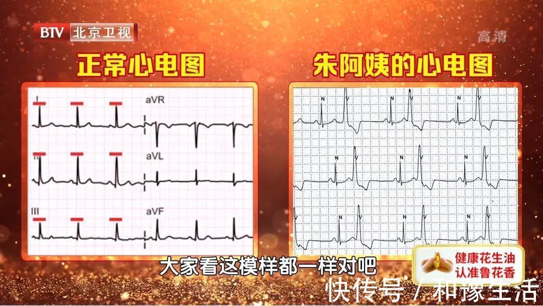 头晕头痛|心跳过慢、过快、乱跳,都是因为它出了问题!一个小方法,提早发现危机~
