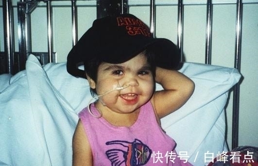 希洛|现实美人鱼女孩:没有双腿长了“人鱼尾”,却从未停止摇摆尾巴