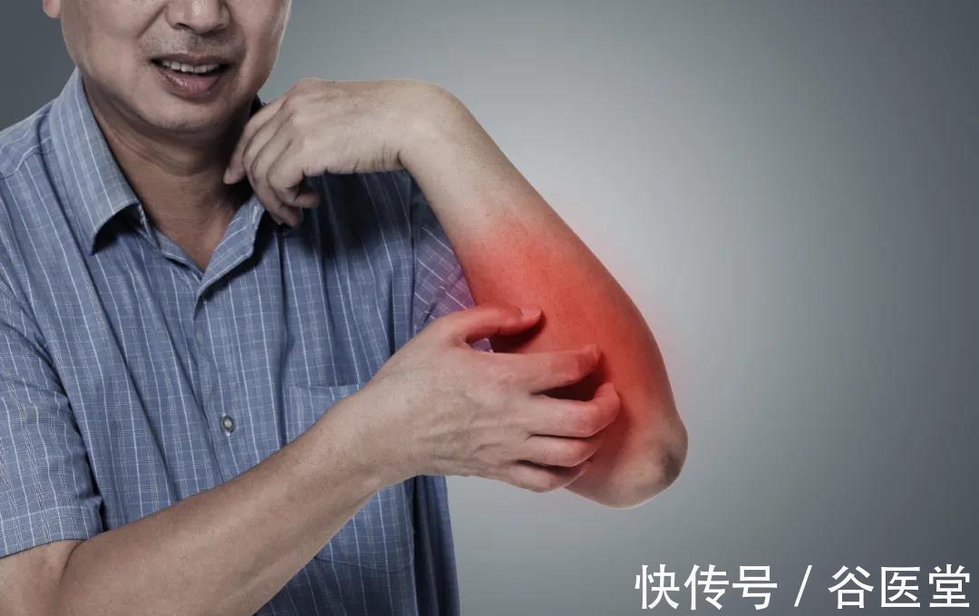 疑难病|夏季皮肤病高发？湖南省名中医曾洪伟运用中医整体疗法，为患者解除困扰！