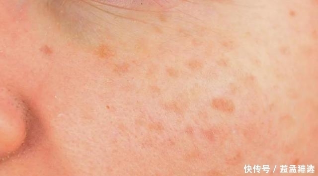 高手|有1物是“美白高手”,不是贴脸的黄瓜,牛奶泡一泡,皮肤白嫩了