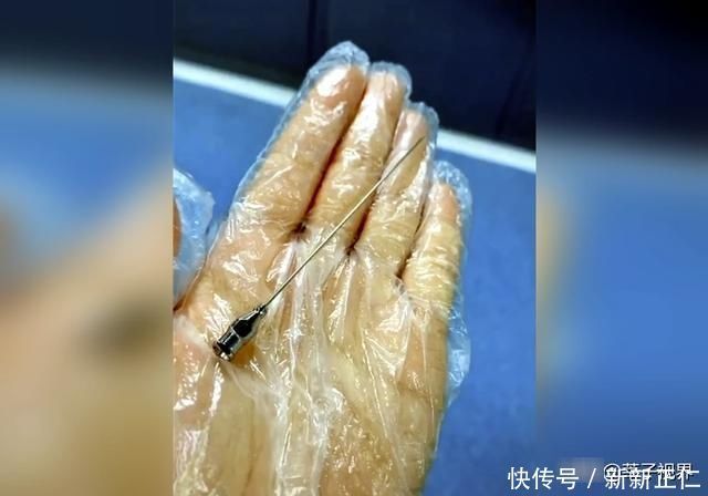 “假如可以重来，我会选择顺产”，95后剖产妈妈的哭诉，值得警醒