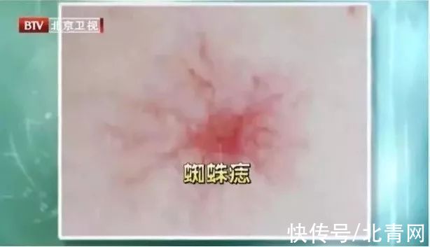 甲亢|各种疾病的早期信号，都在这里了！知道了省钱又救命，赶紧学起来