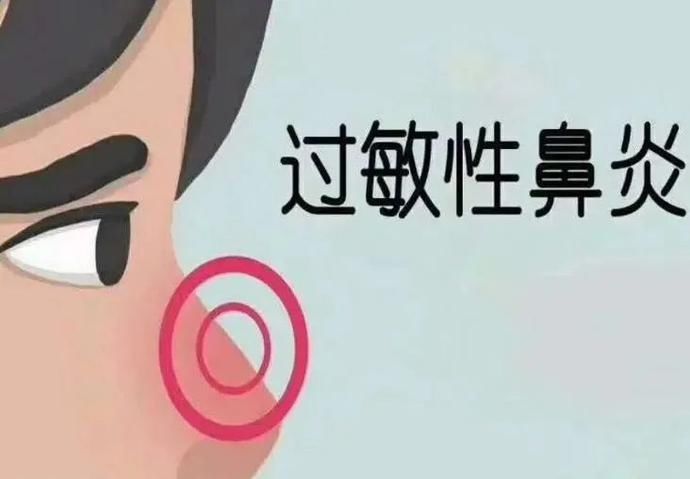 穴位|酷似感冒但却伤脑！这种鼻炎很危险，中医教你几招预防方法